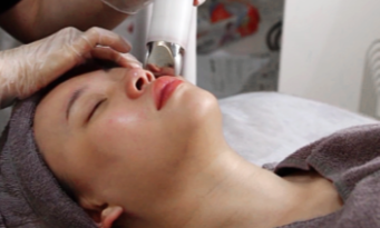 Ageless Allure: The Marvels of Collagen Facial in Singapore